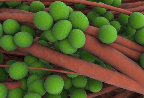Staph is extremely common.