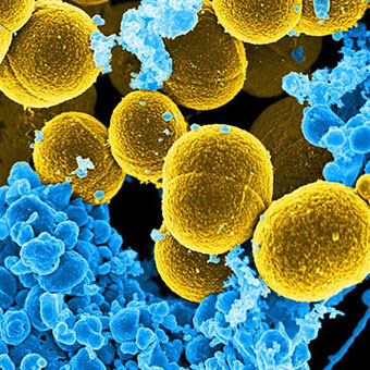 A scanning electron micrograph (SEM) depicts a number of mustard-colored, spheroid-shaped Staphylococcus aureus bacteria.