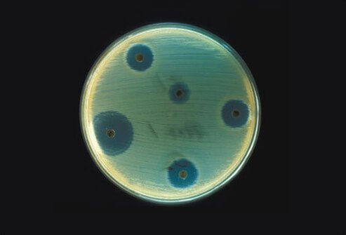 Aerobic bacteria, <i>Staphylococcus aureus</i>, are cultured on an agar plate.