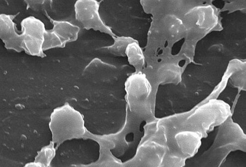 It takes a highly magnified microscope to see it at all.