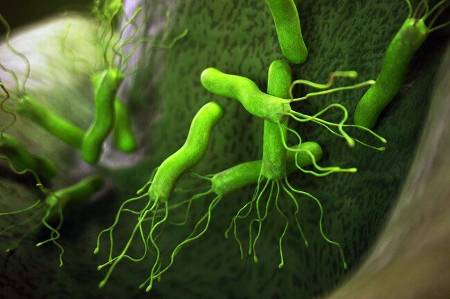 The most frequent cause of ulcers isn't stress or super-spicy food.