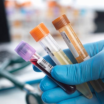 Stool samples are taken to test for causes of stool color changes.