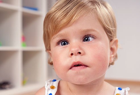 Without treatment, strabismus can worsen over time.