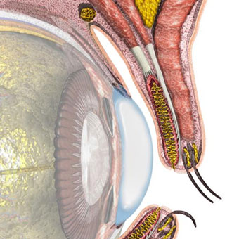 An illustration of the eye