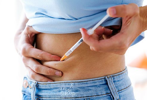 This type of injection is used when other methods of administration might be less effective.