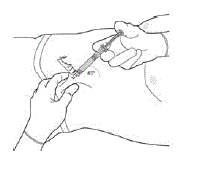 Withdraw the needle at the same angle used for insertion
and release the pinched skin - Illustration