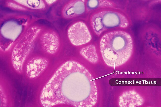 This substance is a natural part of the connective tissue in your bones and cartilage.