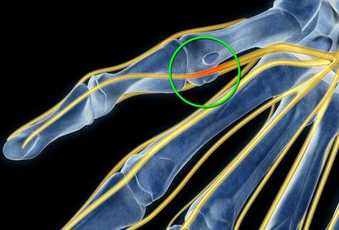 Localized itching may be due to a pinched nerve.