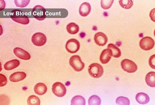 Lack of sufficient red blood cells may make you itch.