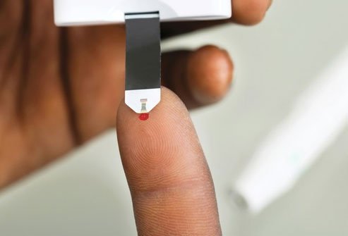 Yeast infections and circulatory problems associated with diabetes may produce itching.