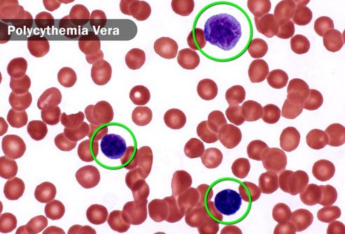 Itchiness is sometimes associated with certain types of cancer.
