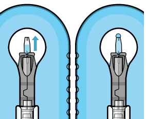 Dome of drug solution forms at tip
of implant as viewed under magnification - Illustration