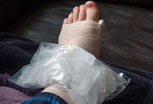 RICE is a useful remedy for swollen feet. 
