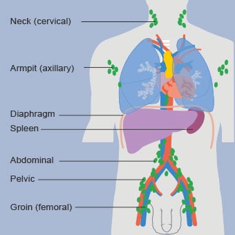 Illustration of lymph node locations.