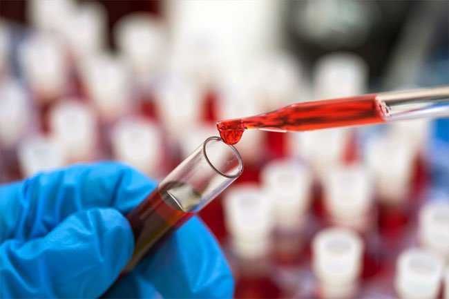 It's possible you could have liver disease without knowing it.
