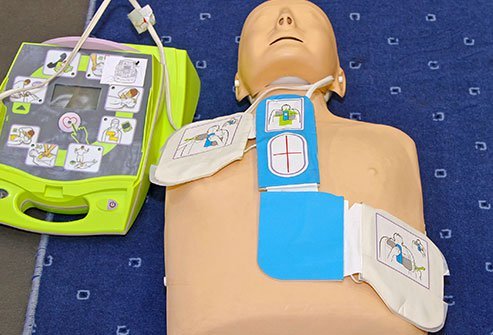 Synchronized Electrical Cardioversion