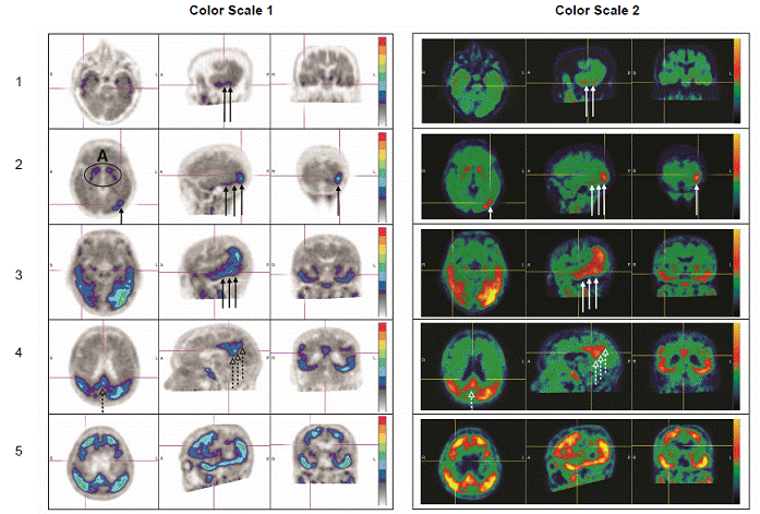 Positive Scan Examples - Illustration