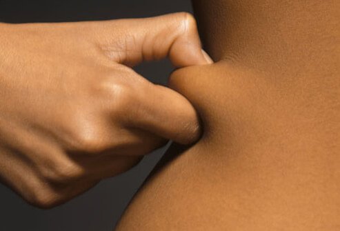 Everyone (even those who you think have the perfect body) has extra skin in certain body areas -- around the waist especially.
