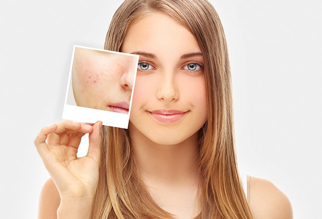Your skin has a direct connection to your brain. Recent research has shown that your skin can perceive stress and respond to it.