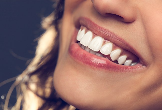 hydroperoxide teeth whitening