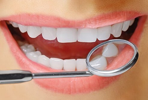 There are two ways this is commonly done: bleaching and non-bleaching whitening products.