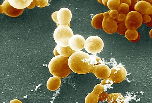 The cause (or causes) of seborrheic dermatitis remains obscure.