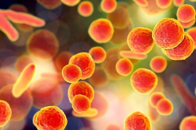If you have a urinary tract infection (UTI), you may notice your urine has an odor due to buildup of bacteria.