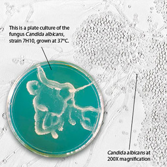 A plate culture of the fungus Candida albicans, strain 7H10, grown at 37 C and Candida albicans at 200X magnification.