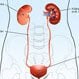 Kidney (Renal) Failure