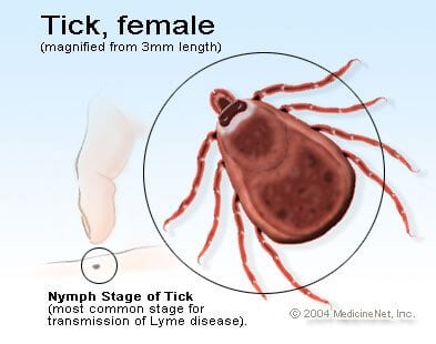 Picture of a tick