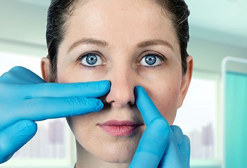 Tip Rhinoplasty