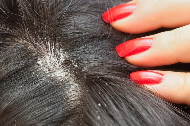 Hair tends to turn thin and grey with age and oil glands do not work as well.