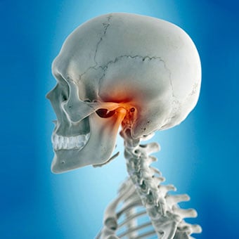 TMJ refers to the syndrome affecting the temporomandibular joint, where the jaw meets the skull.