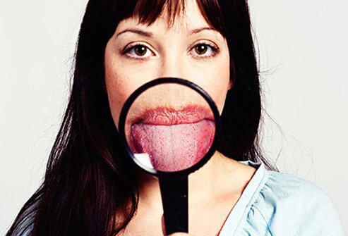 You taste buds are too small to see on your tongue. 