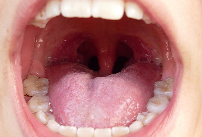 what are the different parts of the roof of the mouth