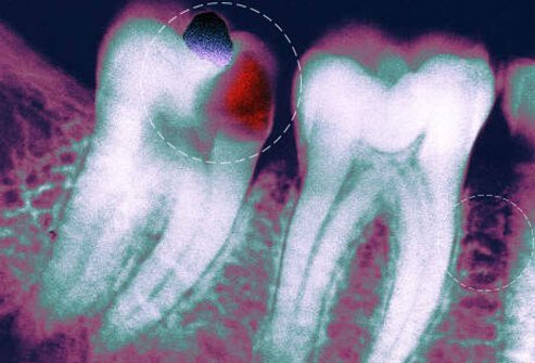It's easy to ignore subtle mouth problems. But when you do, they can get worse.