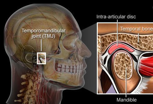 TMJ (temporomandibular joint) syndrome is a problem with the tiny, sliding hinge joint just in front of your ear.