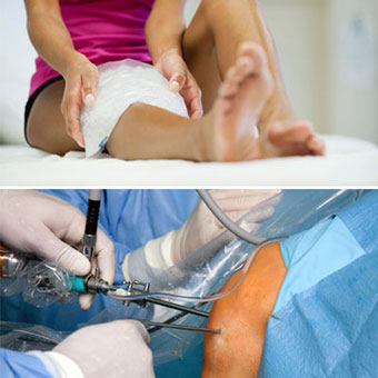 A woman ices her knee after injury, and a surgeon performs knee arthroscopy.