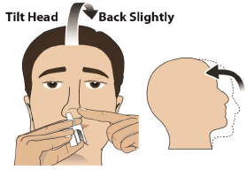 While keeping the device in your nose, tilt your head
back slightly  - Illustration