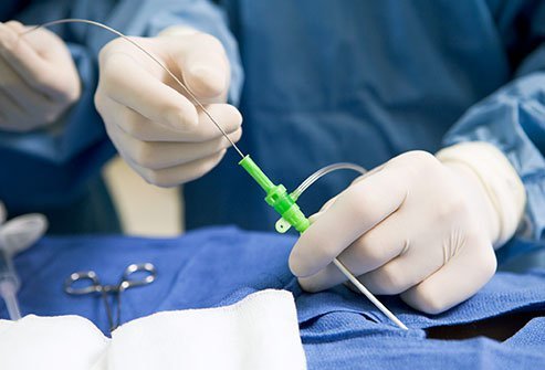 The procedure helps doctors find and fix any heart problems.