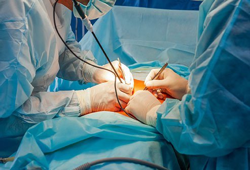 A TAP or transversus abdominis plane block numbs the abdominal muscles and skin in preparation for surgery.