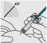 Remove needle cover - Illustration