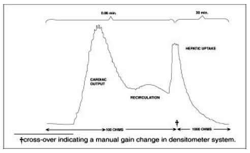 Clearance pattern - Illustration