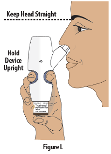 Insert the sparay nozzle into your first nostril as far as comfortable - Illustration