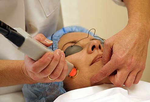 Photo of woman laser treatment.