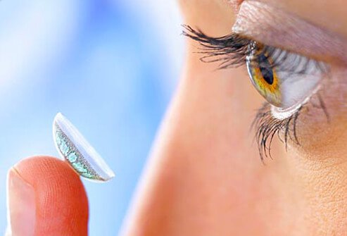 Photo of woman applying contact lens.