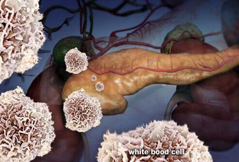 Picture of an Immune System Attack