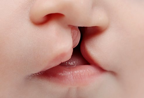 The palate is a structure that forms the roof of the mouth.
