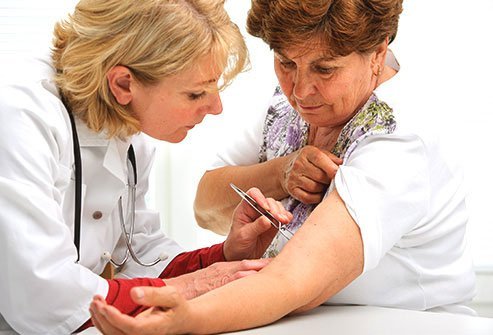 Seek your doctor’s help if you need treatment for stubborn warts.