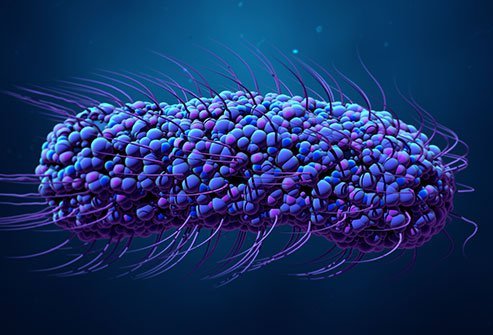 Illustration of Typhoid Fever 